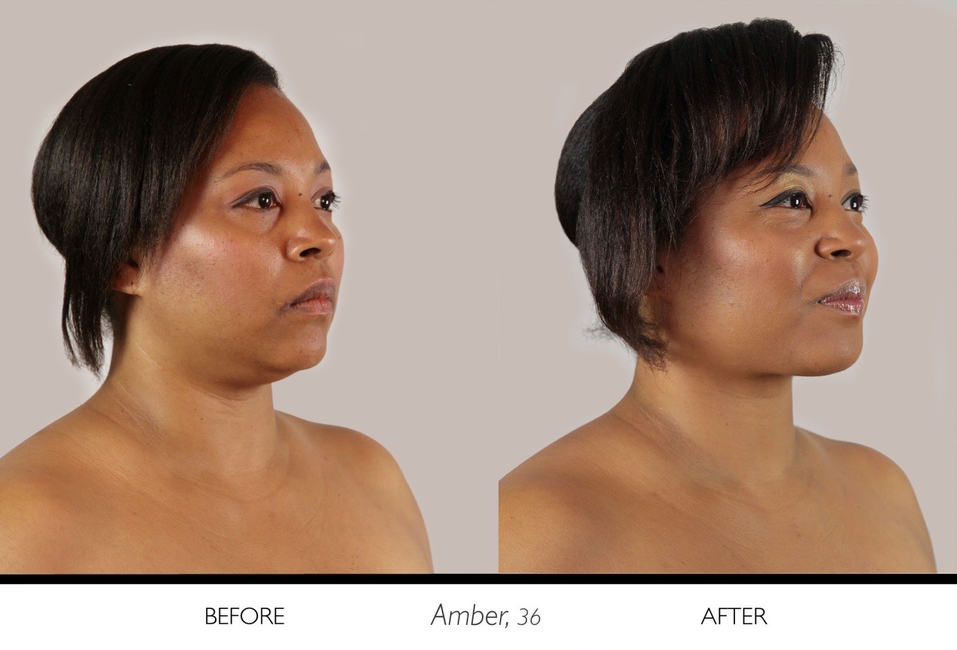 Amber 36 before and after