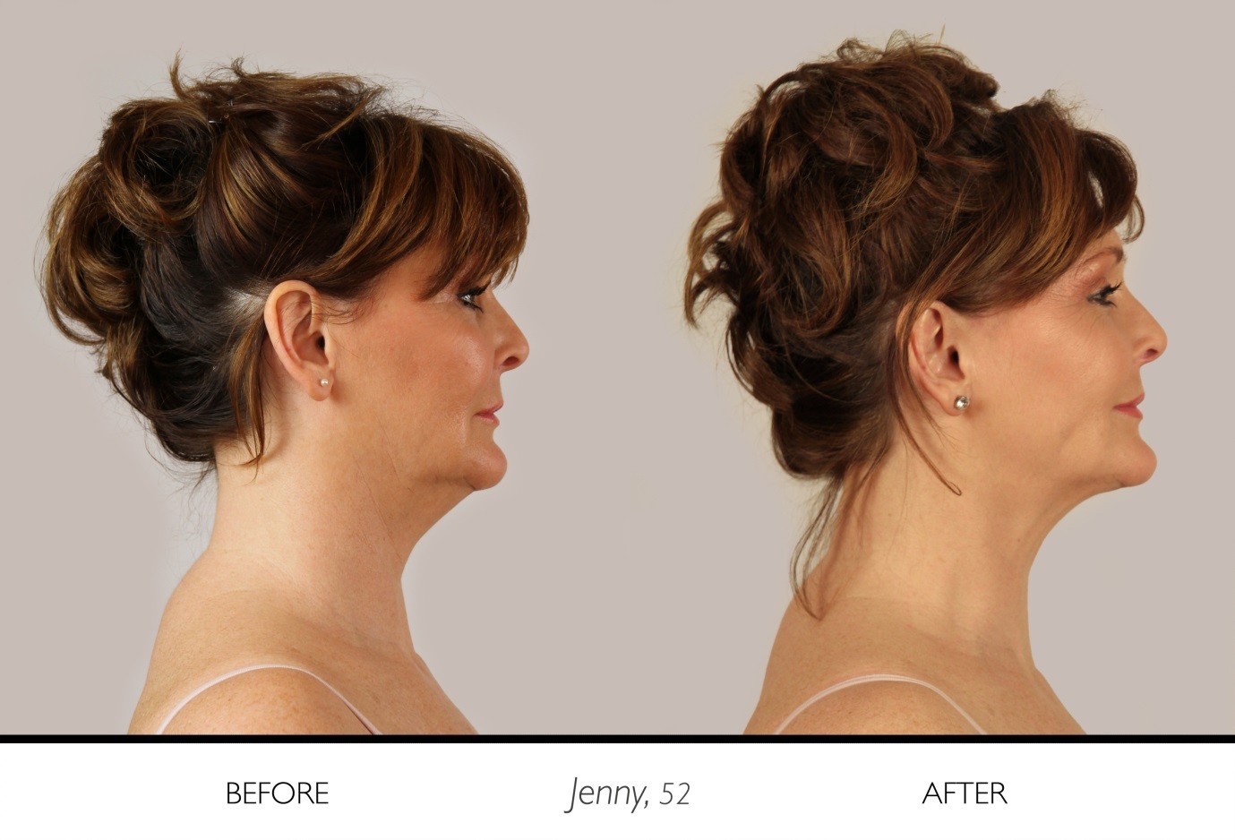 Jenny 52 before and after